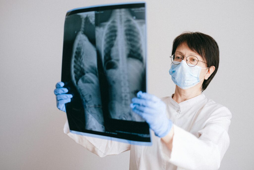 Doctor in protective gear examining chest x-ray for diagnosis. LungExpand Pro